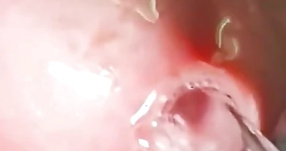 Oh My God! I Penetrate My Penis Eye!